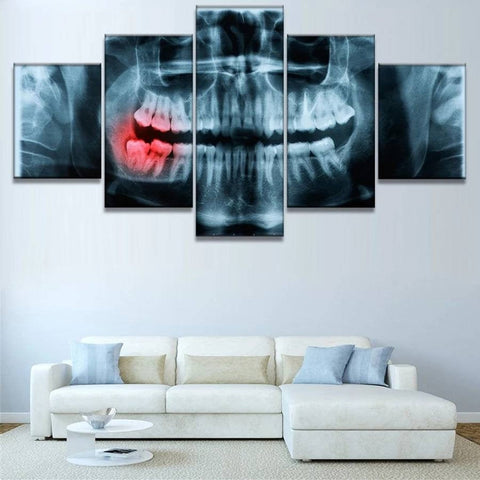 Dentist Teeth Xray Wall Art Canvas Printing Decor