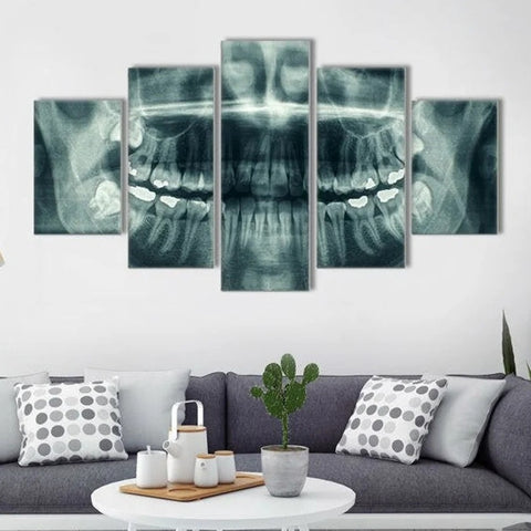 X-ray Dental Face Wall Art Canvas Printing Decor